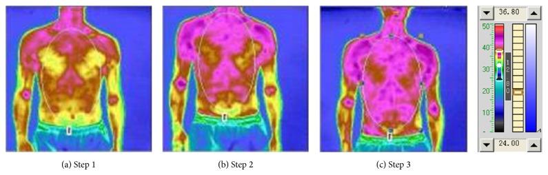 https://cdn.ncbi.nlm.nih.gov/pmc/blobs/bfb7/4363508/688e734cb472/BMRI2015-492391.002.jpg