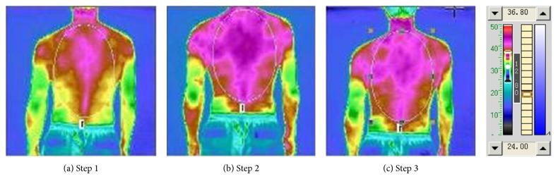 https://cdn.ncbi.nlm.nih.gov/pmc/blobs/bfb7/4363508/ff0bdf6a577c/BMRI2015-492391.003.jpg