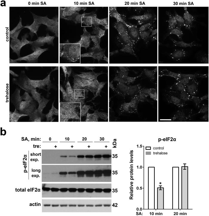 https://cdn.ncbi.nlm.nih.gov/pmc/blobs/bfd0/5343430/052070471521/srep44088-f4.jpg