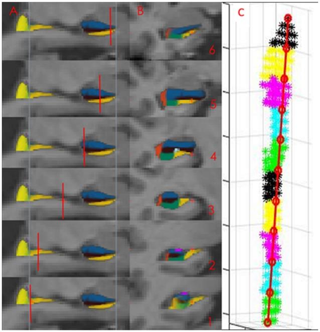 https://cdn.ncbi.nlm.nih.gov/pmc/blobs/bfd1/5611434/239f54e72348/fnagi-09-00306-g0001.jpg