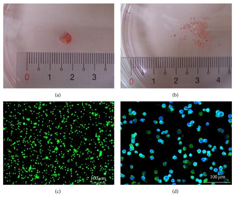 https://cdn.ncbi.nlm.nih.gov/pmc/blobs/bfd3/4310262/3beb1602fb8e/BMRI2015-470283.002.jpg