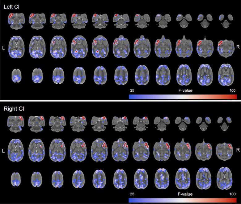 https://cdn.ncbi.nlm.nih.gov/pmc/blobs/bfd4/12344515/83d535dd43a2/IMAG.a.109_fig2.jpg