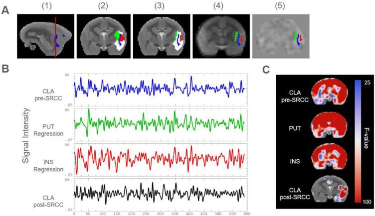 https://cdn.ncbi.nlm.nih.gov/pmc/blobs/bfd4/12344515/9aa48e69263a/IMAG.a.109_fig1.jpg
