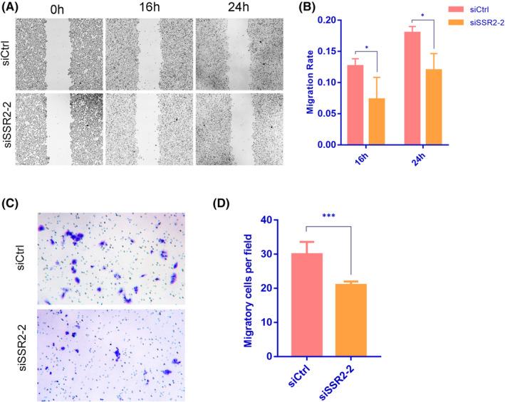 https://cdn.ncbi.nlm.nih.gov/pmc/blobs/bfd5/9170819/ed6c466ac9d0/JCMM-26-3169-g006.jpg