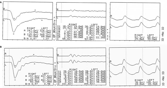 https://cdn.ncbi.nlm.nih.gov/pmc/blobs/bfd9/5221811/3c64a15b13f5/imcrj-10-001Fig3.jpg