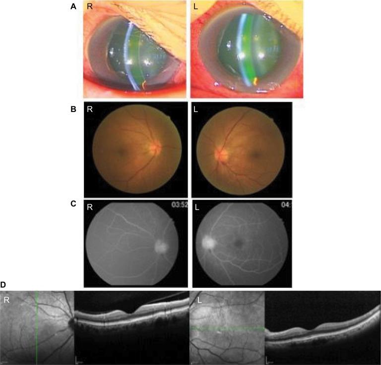 https://cdn.ncbi.nlm.nih.gov/pmc/blobs/bfd9/5221811/f997b437fd22/imcrj-10-001Fig1.jpg