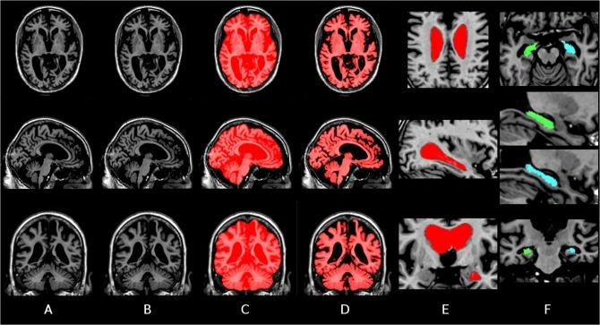 https://cdn.ncbi.nlm.nih.gov/pmc/blobs/bfdd/4547713/a7580ea67832/pone.0133352.g003.jpg
