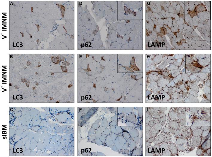 https://cdn.ncbi.nlm.nih.gov/pmc/blobs/bfe2/8018061/55fe7226b6d0/BPA-30-261-g002.jpg