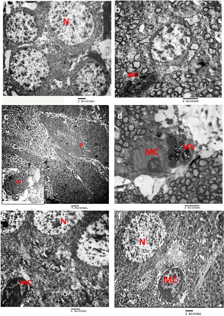 https://cdn.ncbi.nlm.nih.gov/pmc/blobs/bfe5/11033245/b3392fbe438f/424_2024_2933_Fig6_HTML.jpg