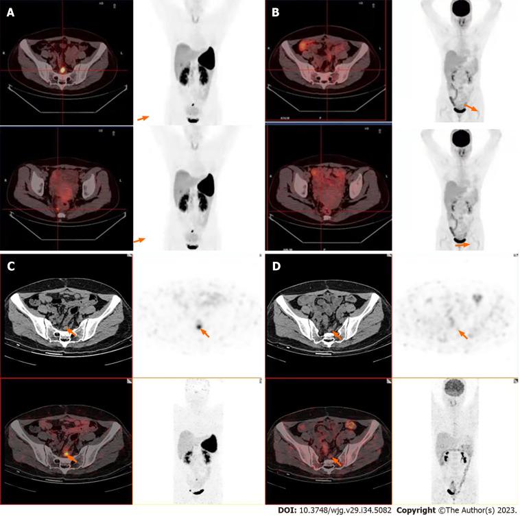https://cdn.ncbi.nlm.nih.gov/pmc/blobs/bff9/10518740/6217a6433628/WJG-29-5082-g001.jpg