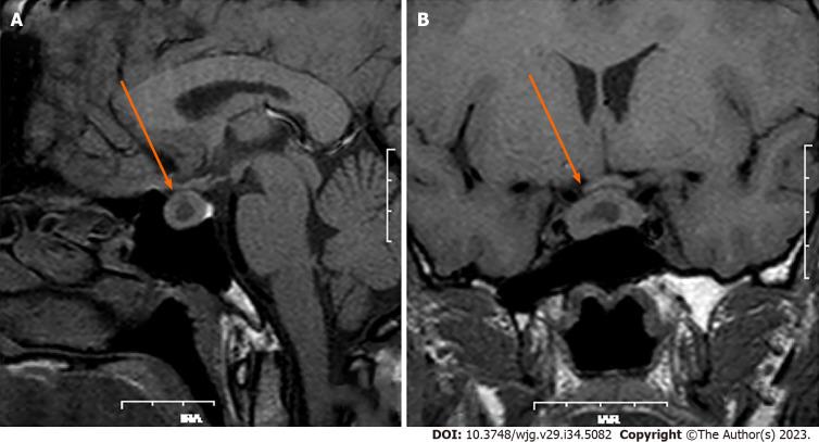 https://cdn.ncbi.nlm.nih.gov/pmc/blobs/bff9/10518740/7cb2c3efe914/WJG-29-5082-g005.jpg