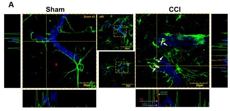 https://cdn.ncbi.nlm.nih.gov/pmc/blobs/c002/5532590/a8aeae7f2e06/brainsci-07-00077-g002a.jpg