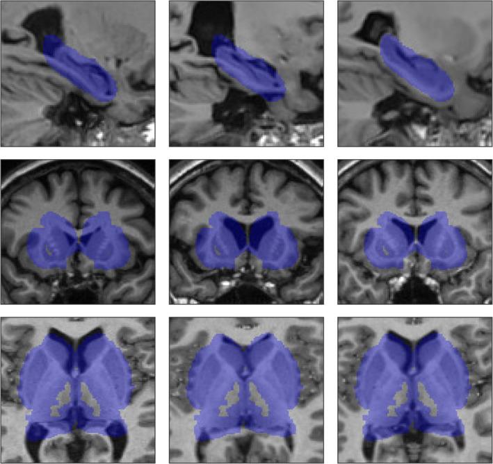 https://cdn.ncbi.nlm.nih.gov/pmc/blobs/c006/7267949/2a12e70645f7/HBM-41-309-g002.jpg