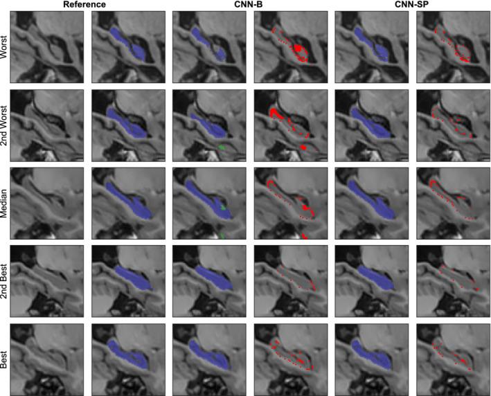 https://cdn.ncbi.nlm.nih.gov/pmc/blobs/c006/7267949/88f579a8ded5/HBM-41-309-g003.jpg