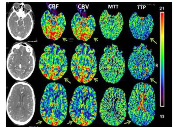 https://cdn.ncbi.nlm.nih.gov/pmc/blobs/c00d/3311605/51bc3c277d34/1865-1380-5-12-1.jpg