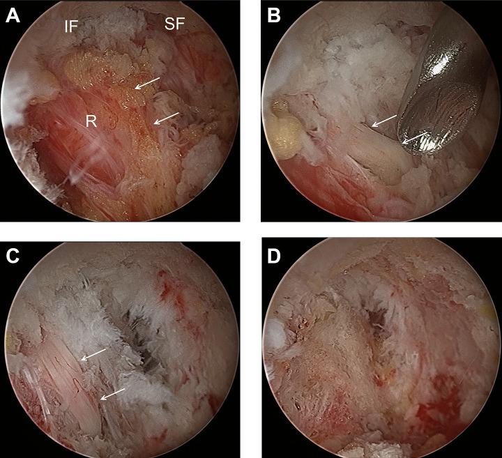 https://cdn.ncbi.nlm.nih.gov/pmc/blobs/c00f/8258823/258a7ec8124e/10.1177_2192568220941446-fig3.jpg