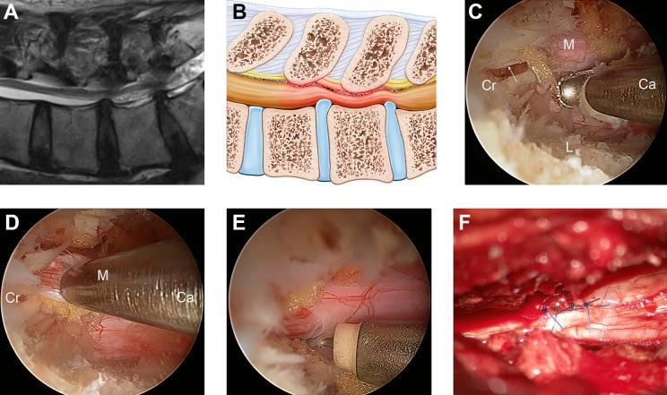 https://cdn.ncbi.nlm.nih.gov/pmc/blobs/c00f/8258823/35ad7fe1fa14/10.1177_2192568220941446-fig2.jpg