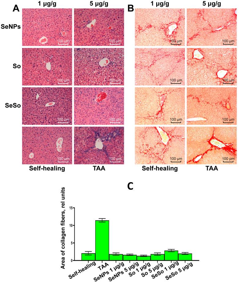 https://cdn.ncbi.nlm.nih.gov/pmc/blobs/c016/10706216/285bd2bb677d/cells-12-02723-g007.jpg