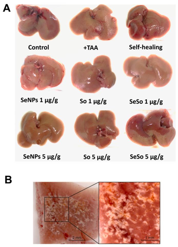 https://cdn.ncbi.nlm.nih.gov/pmc/blobs/c016/10706216/5f519c70cfe7/cells-12-02723-g005.jpg