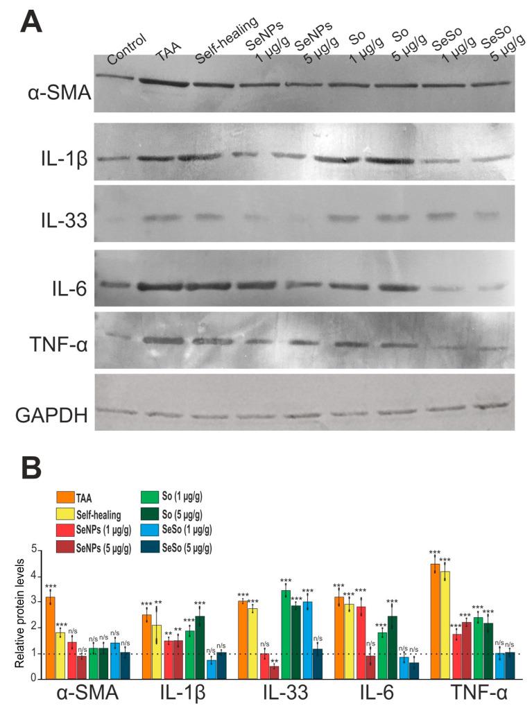 https://cdn.ncbi.nlm.nih.gov/pmc/blobs/c016/10706216/77f021cc75d5/cells-12-02723-g010.jpg