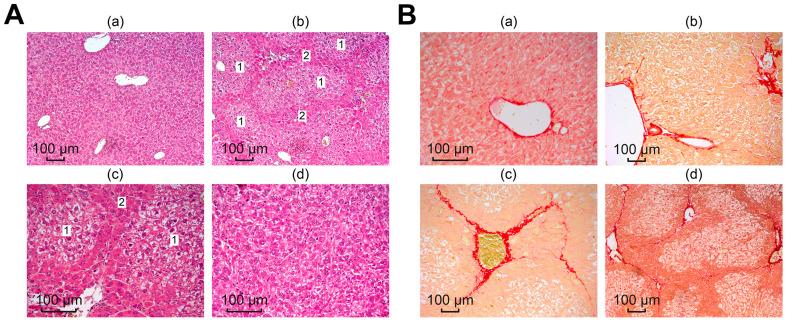 https://cdn.ncbi.nlm.nih.gov/pmc/blobs/c016/10706216/8385661d87e0/cells-12-02723-g006.jpg