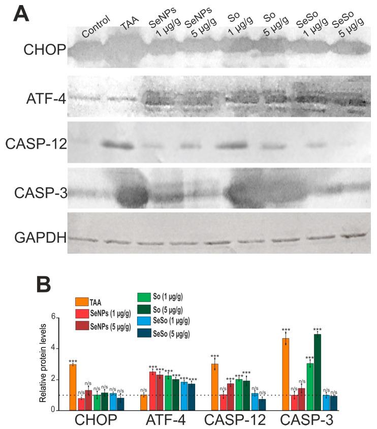 https://cdn.ncbi.nlm.nih.gov/pmc/blobs/c016/10706216/83966eff2eb9/cells-12-02723-g014.jpg