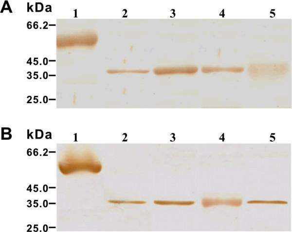 https://cdn.ncbi.nlm.nih.gov/pmc/blobs/c017/3851530/b8bea74402c2/1297-9716-44-90-3.jpg