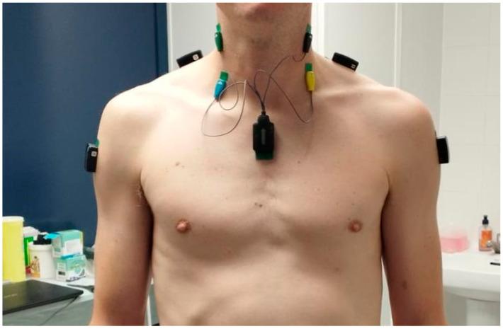 https://cdn.ncbi.nlm.nih.gov/pmc/blobs/c01a/11642049/b04bce0c3c72/jcm-13-07288-g001.jpg