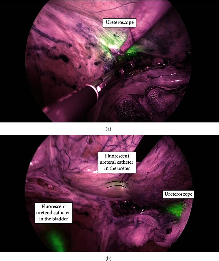 https://cdn.ncbi.nlm.nih.gov/pmc/blobs/c01d/8844347/8e6fb72b9be9/CRIT2022-9948425.002.jpg