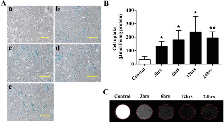 https://cdn.ncbi.nlm.nih.gov/pmc/blobs/c01f/4700528/f9dbd1ac6f9b/srep18746-f4.jpg
