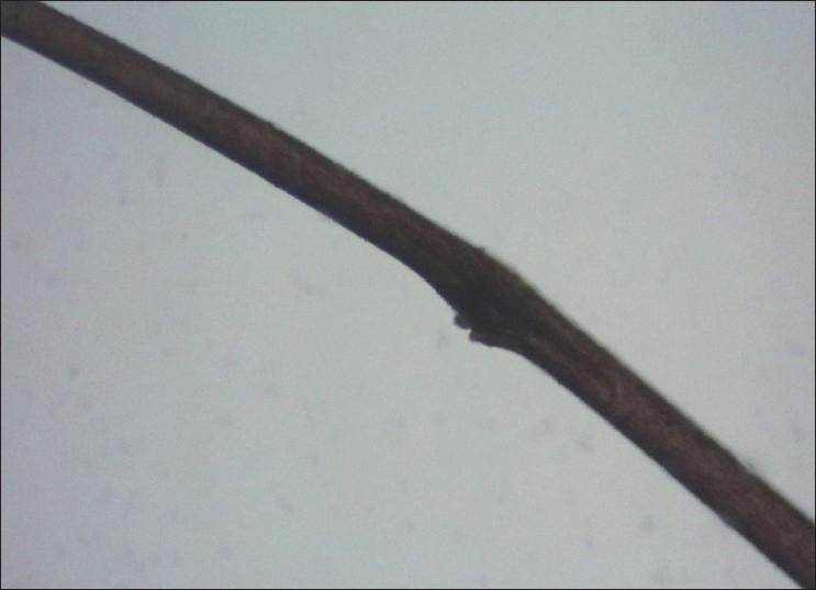https://cdn.ncbi.nlm.nih.gov/pmc/blobs/c025/3107955/12028bfc501e/IJT-2-110-g004.jpg
