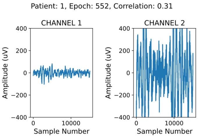 https://cdn.ncbi.nlm.nih.gov/pmc/blobs/c026/8151443/d37c80ee2c2e/sensors-21-03316-g002.jpg