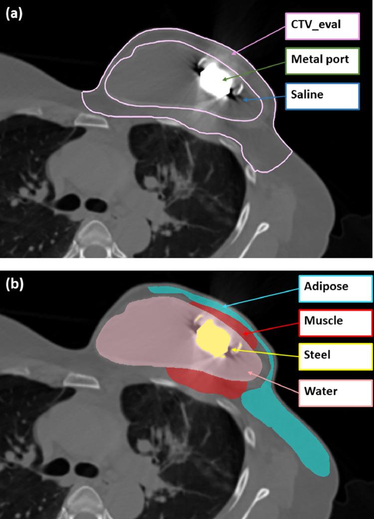 https://cdn.ncbi.nlm.nih.gov/pmc/blobs/c02a/8590033/98b47fa7b80f/gr1.jpg