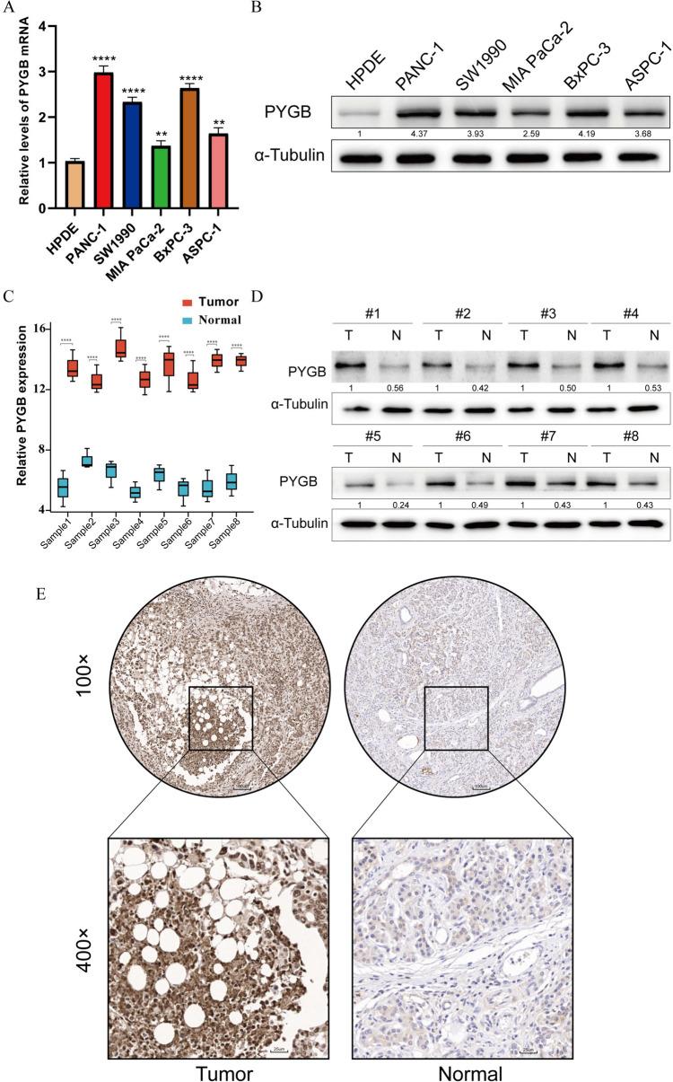 https://cdn.ncbi.nlm.nih.gov/pmc/blobs/c02c/10940407/55065dd3f716/432_2024_5644_Fig7_HTML.jpg