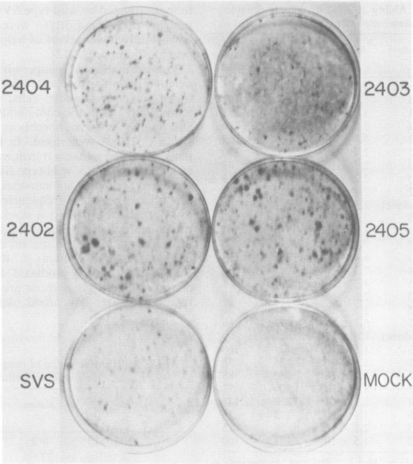 https://cdn.ncbi.nlm.nih.gov/pmc/blobs/c02d/256152/aa38297530dc/jvirol00155-0140-a.jpg