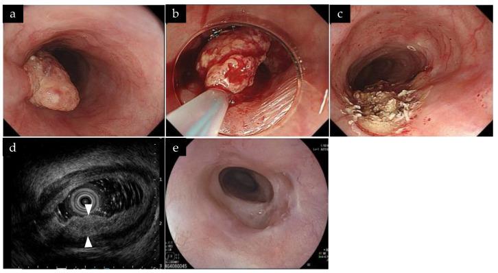 https://cdn.ncbi.nlm.nih.gov/pmc/blobs/c02e/10303686/57ca9166f633/life-13-01276-g001.jpg