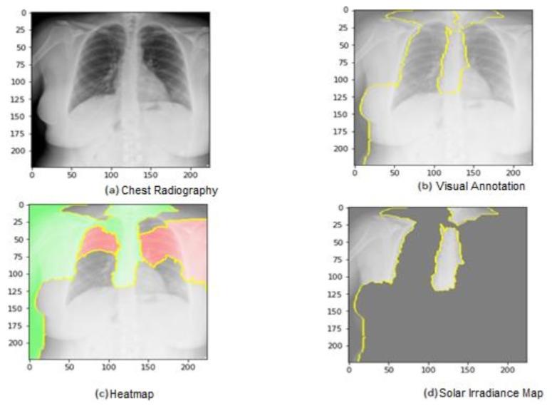 https://cdn.ncbi.nlm.nih.gov/pmc/blobs/c035/10532018/25e9bf2732c7/jimaging-09-00177-g019.jpg