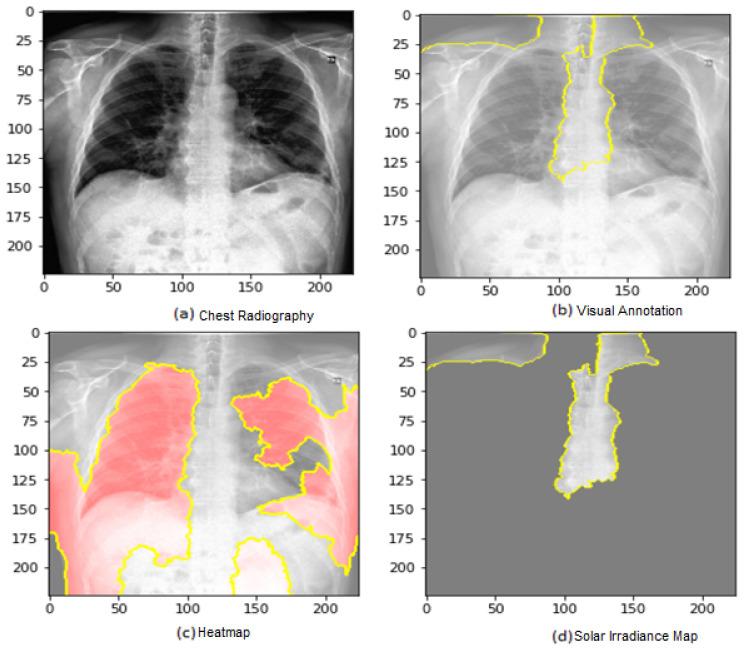 https://cdn.ncbi.nlm.nih.gov/pmc/blobs/c035/10532018/2ea34202aad2/jimaging-09-00177-g017.jpg