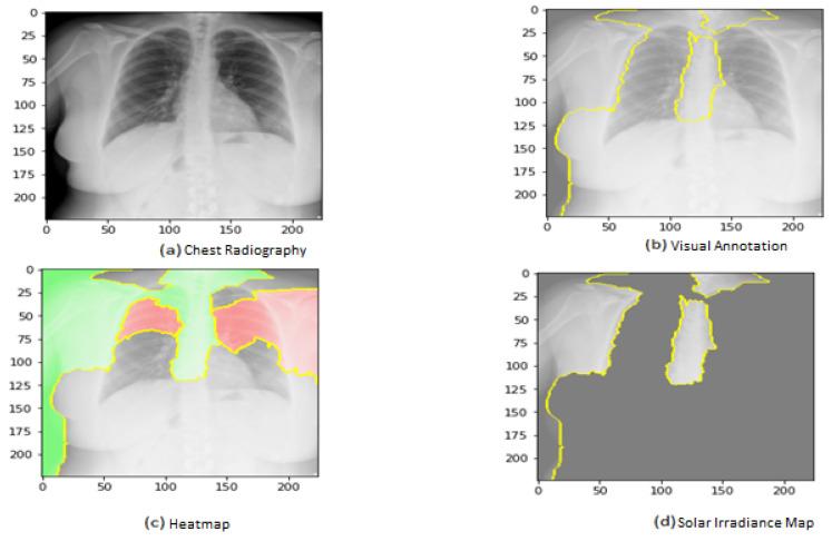 https://cdn.ncbi.nlm.nih.gov/pmc/blobs/c035/10532018/7d6fb1c4f850/jimaging-09-00177-g015.jpg