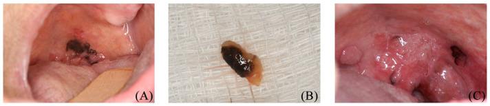 https://cdn.ncbi.nlm.nih.gov/pmc/blobs/c035/8064661/488e9b2d0b37/10.1177_2632010X211009819-fig1.jpg