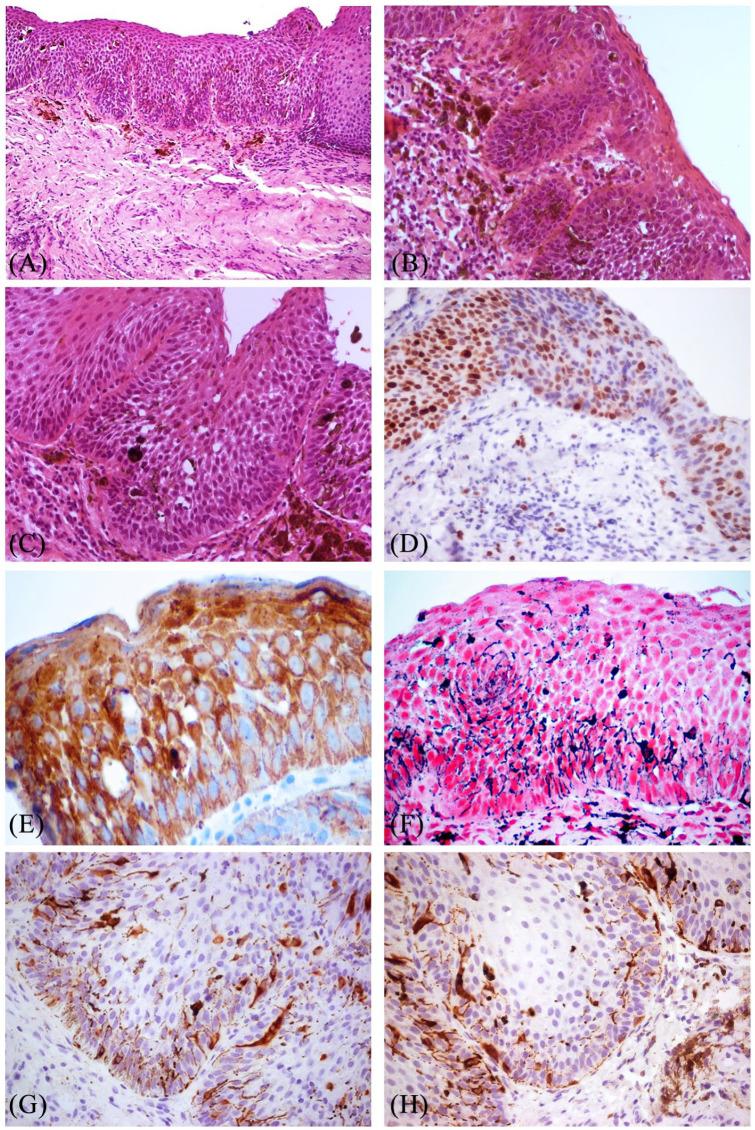 https://cdn.ncbi.nlm.nih.gov/pmc/blobs/c035/8064661/88278e80f787/10.1177_2632010X211009819-fig2.jpg