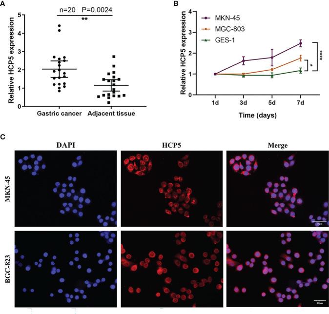https://cdn.ncbi.nlm.nih.gov/pmc/blobs/c040/8252797/8d2ded47a7cd/fonc-11-684531-g003.jpg