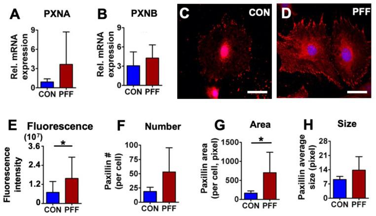 https://cdn.ncbi.nlm.nih.gov/pmc/blobs/c045/7664694/a9c3f9f72a65/ijms-21-08361-g004.jpg