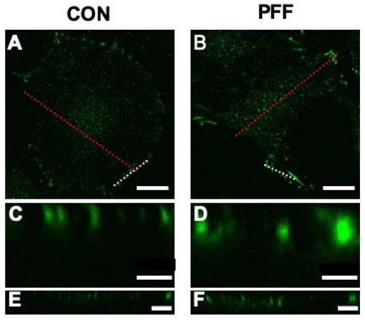 https://cdn.ncbi.nlm.nih.gov/pmc/blobs/c045/7664694/f7cd7fb9a1c0/ijms-21-08361-g0A1.jpg