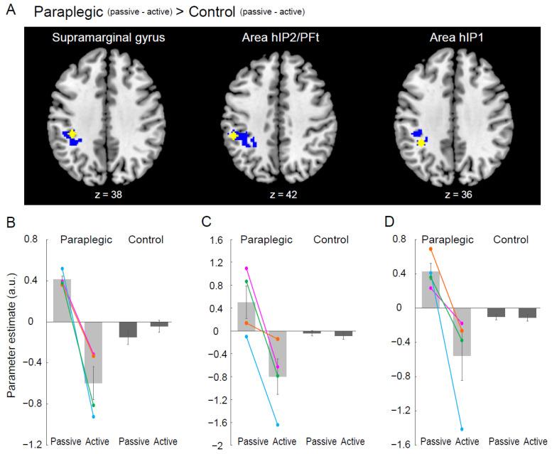 https://cdn.ncbi.nlm.nih.gov/pmc/blobs/c04e/9599078/744d9bdbeb2b/brainsci-12-01295-g005.jpg