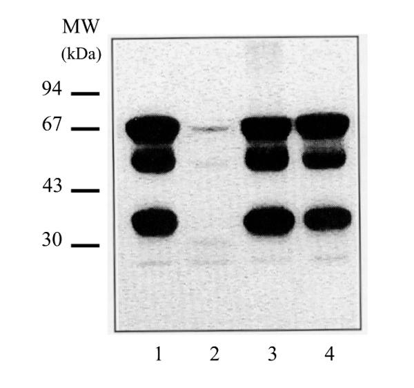 https://cdn.ncbi.nlm.nih.gov/pmc/blobs/c052/13922/eb2c56dc7c2d/bcr-2-6-444-5.jpg