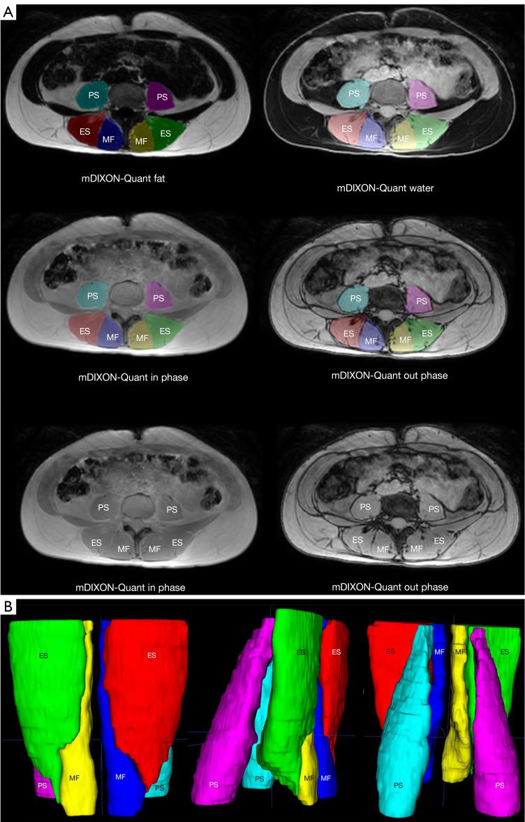 https://cdn.ncbi.nlm.nih.gov/pmc/blobs/c055/11320528/00af2a3f73a5/qims-14-08-6015-f2.jpg