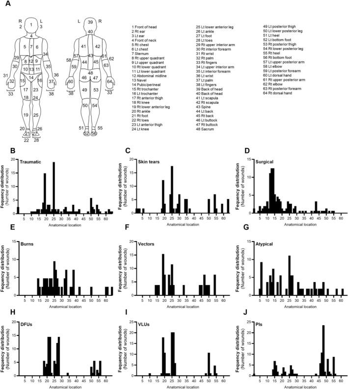 https://cdn.ncbi.nlm.nih.gov/pmc/blobs/c055/11896689/d84c41293991/IWJ-22-e70155-g001.jpg