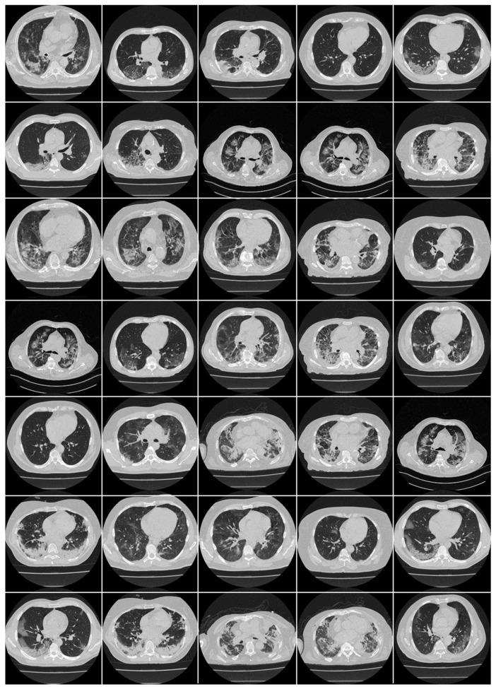 https://cdn.ncbi.nlm.nih.gov/pmc/blobs/c056/9221733/00129f2e227a/diagnostics-12-01482-g002.jpg