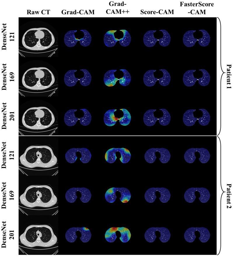 https://cdn.ncbi.nlm.nih.gov/pmc/blobs/c056/9221733/0458be332ab2/diagnostics-12-01482-g013.jpg